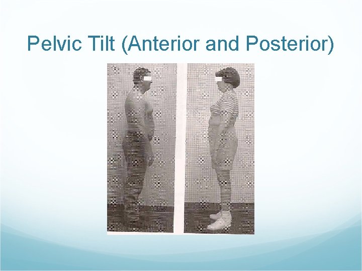 Pelvic Tilt (Anterior and Posterior) 