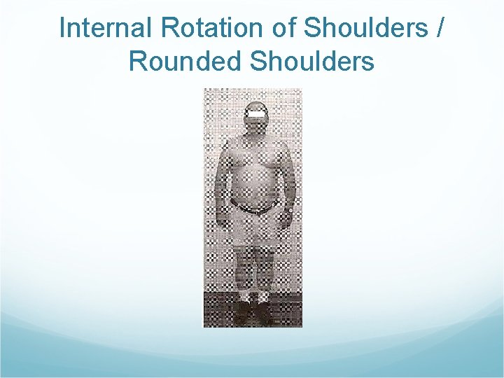 Internal Rotation of Shoulders / Rounded Shoulders 
