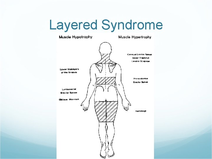 Layered Syndrome 