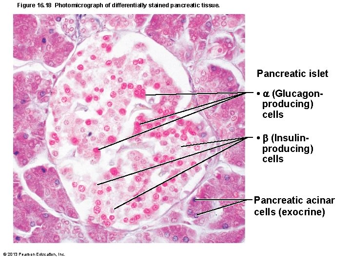 Figure 16. 18 Photomicrograph of differentially stained pancreatic tissue. Pancreatic islet • (Glucagonproducing) cells