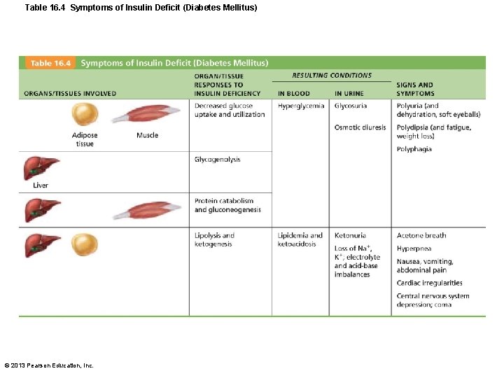 Table 16. 4 Symptoms of Insulin Deficit (Diabetes Mellitus) © 2013 Pearson Education, Inc.