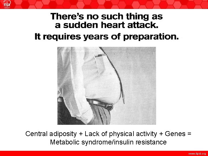 Central adiposity + Lack of physical activity + Genes = Metabolic syndrome/insulin resistance www.