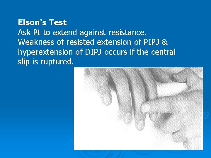 Elson's Test Ask Pt to extend against resistance. Weakness of resisted extension of PIPJ