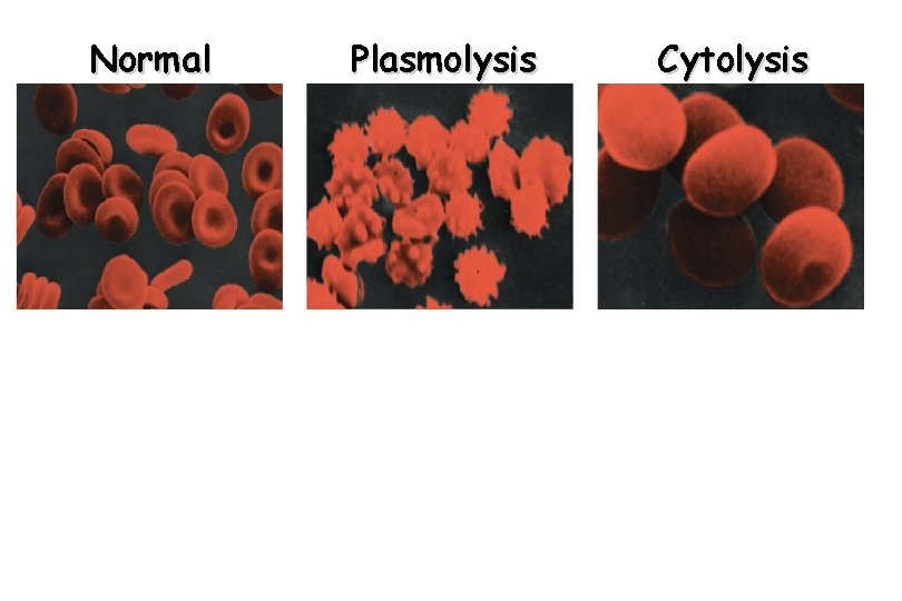 Normal Plasmolysis Cytolysis 