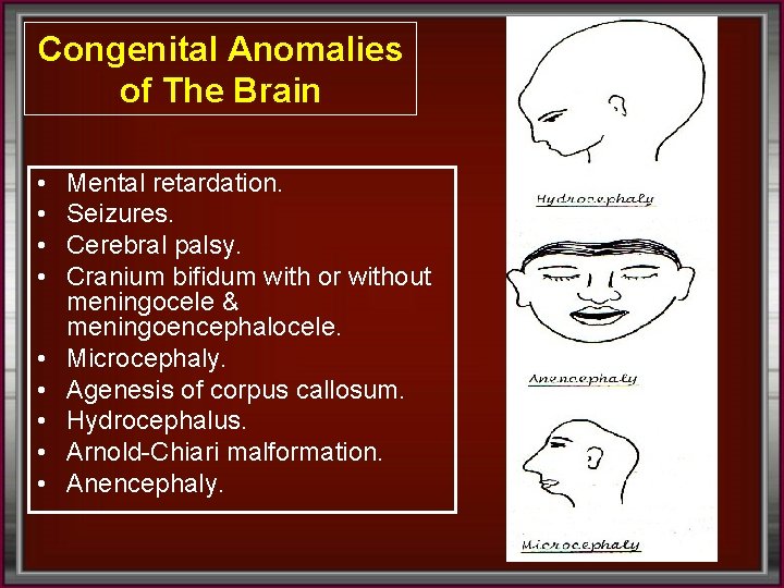 Congenital Anomalies of The Brain • • • Mental retardation. Seizures. Cerebral palsy. Cranium