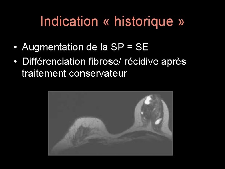 Indication « historique » • Augmentation de la SP = SE • Différenciation fibrose/