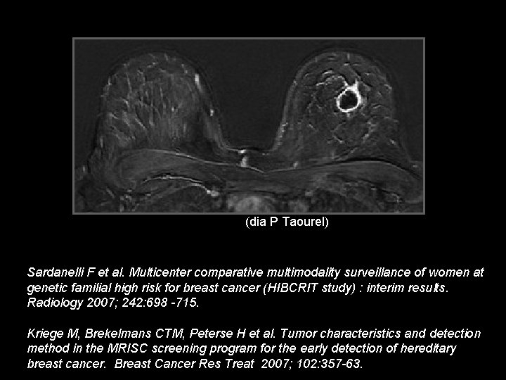 (dia P Taourel) Sardanelli F et al. Multicenter comparative multimodality surveillance of women at