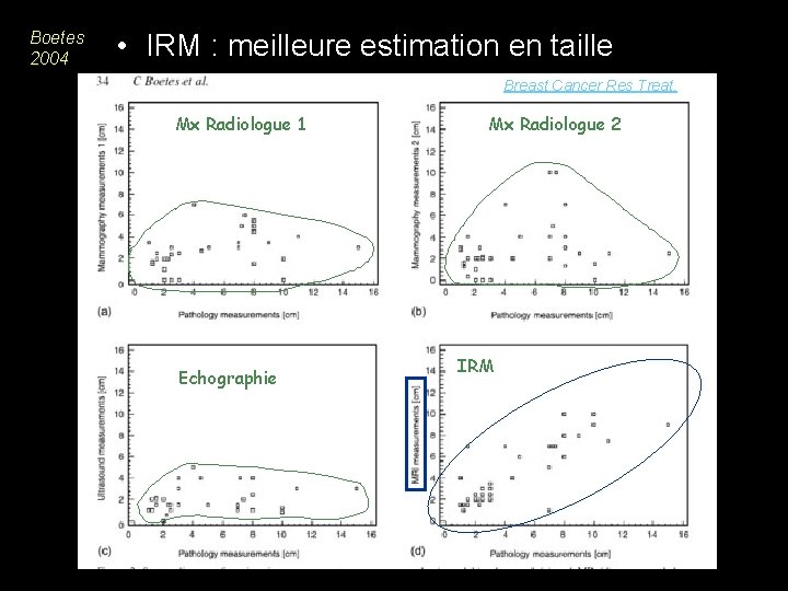 Boetes 2004 • IRM : meilleure estimation en taille Breast Cancer Res Treat. 2004