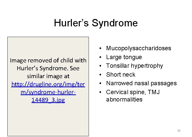 Hurler’s Syndrome Image removed of child with Hurler’s Syndrome. See similar image at http: