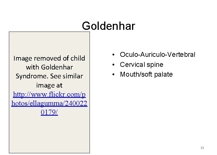 Goldenhar Image removed of child with Goldenhar Syndrome. See similar image at http: //www.