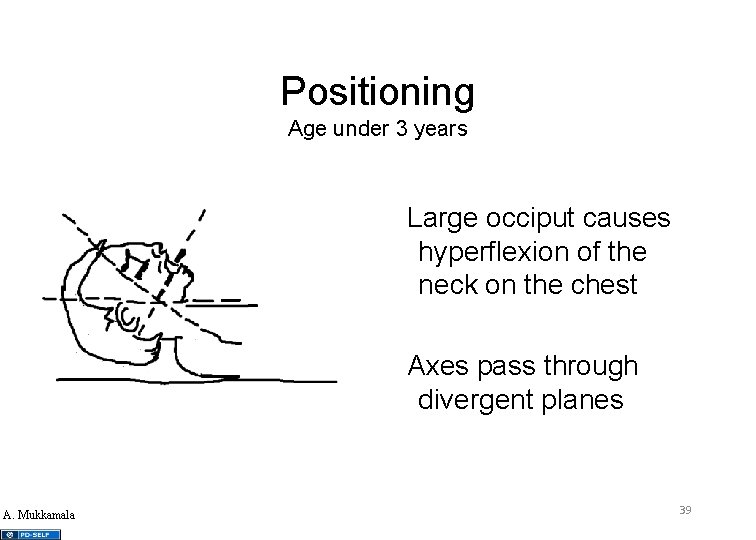 Positioning Age under 3 years Large occiput causes hyperflexion of the neck on the