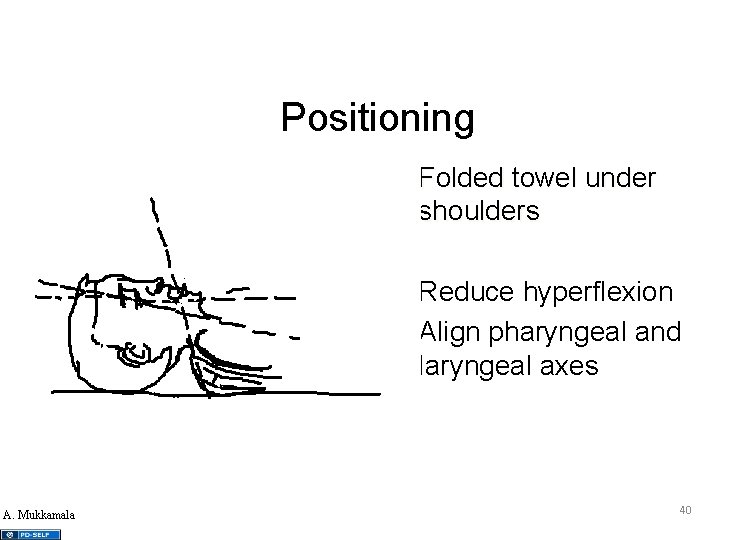 Positioning • Folded towel under shoulders • Reduce hyperflexion • Align pharyngeal and laryngeal