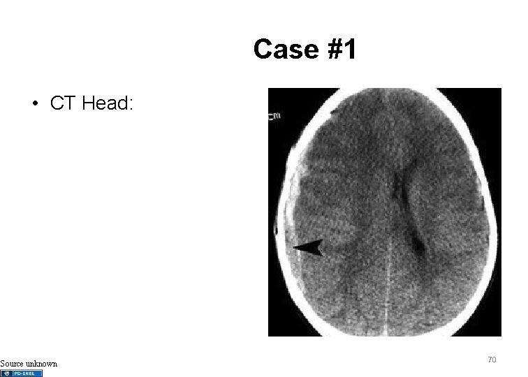 Case #1 • CT Head: Source unknown 70 