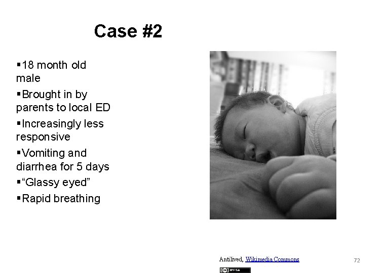 Case #2 § 18 month old male §Brought in by parents to local ED