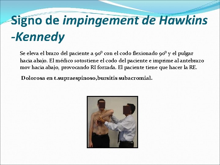 Signo de impingement de Hawkins -Kennedy Se eleva el brazo del paciente a 90⁰