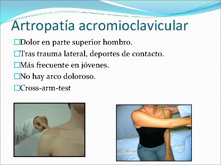 Artropatía acromioclavicular �Dolor en parte superior hombro. �Tras trauma lateral, deportes de contacto. �Más