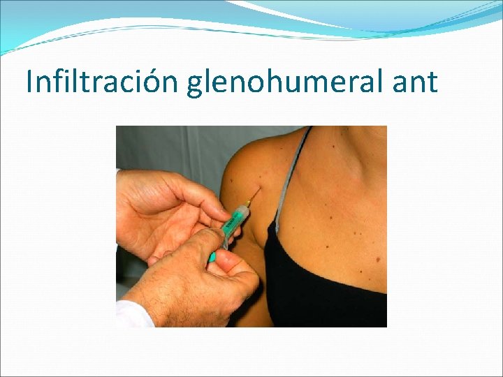 Infiltración glenohumeral ant 