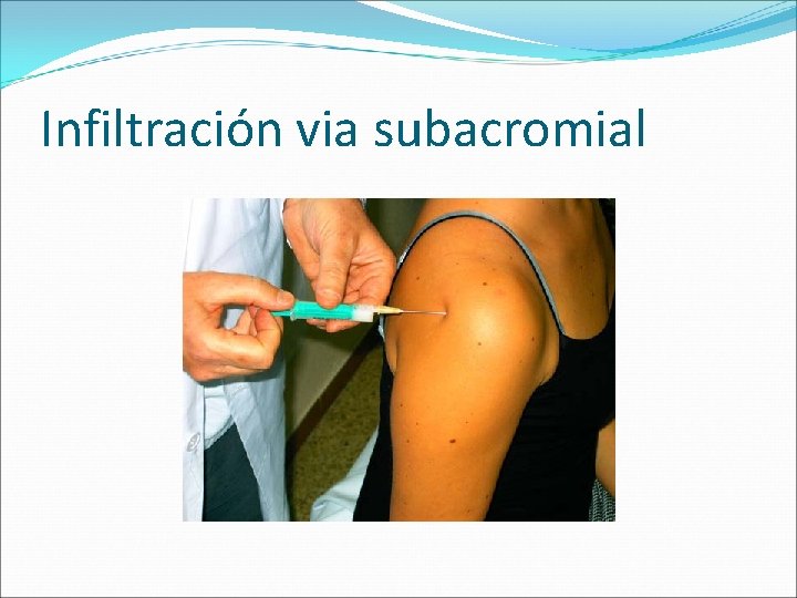 Infiltración via subacromial 