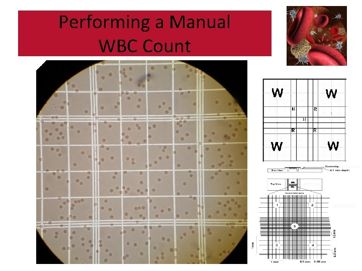 Performing a Manual WBC Count 