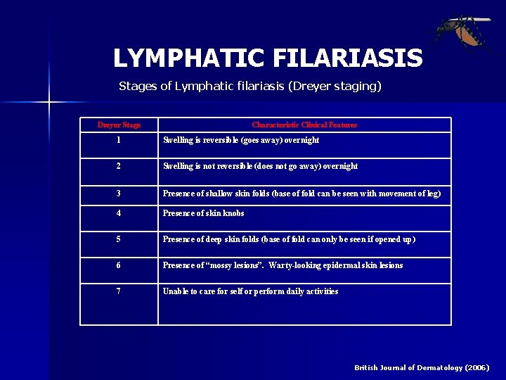 LYMPHATIC FILARIASIS Stages of Lymphatic filariasis (Dreyer staging) Dreyer Stage Characteristic Clinical Features 1