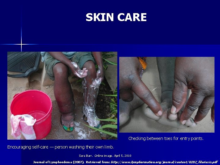 SKIN CARE Checking between toes for entry points. Encouraging self-care — person washing their