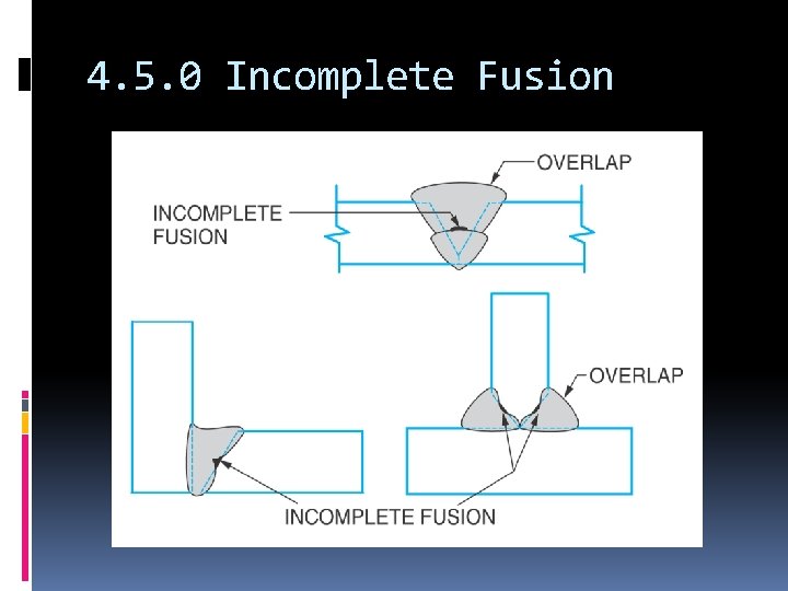 4. 5. 0 Incomplete Fusion 