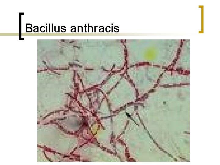 Bacillus anthracis 