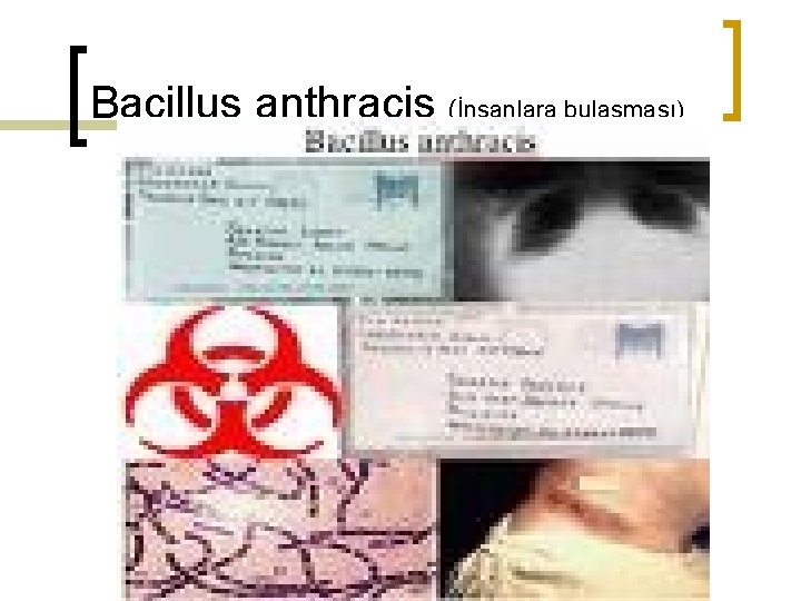 Bacillus anthracis (İnsanlara bulaşması) 