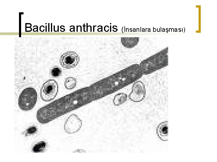 Bacillus anthracis (İnsanlara bulaşması) 