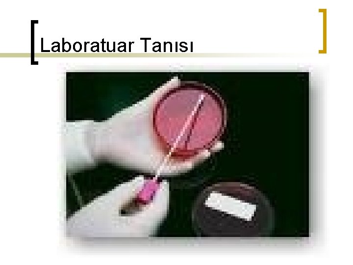 Laboratuar Tanısı 