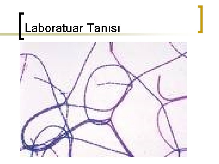 Laboratuar Tanısı 