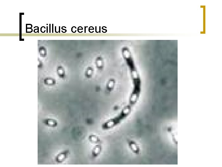 Bacillus cereus 