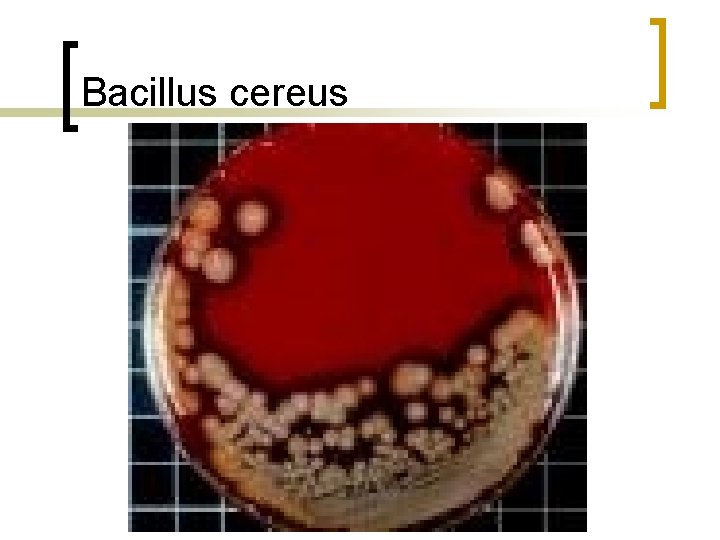 Bacillus cereus 