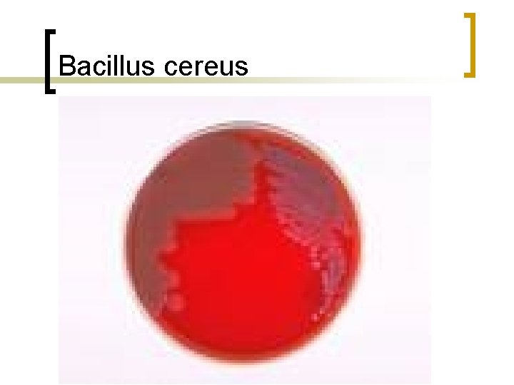 Bacillus cereus 