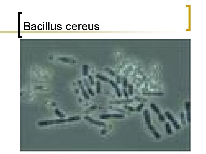 Bacillus cereus 