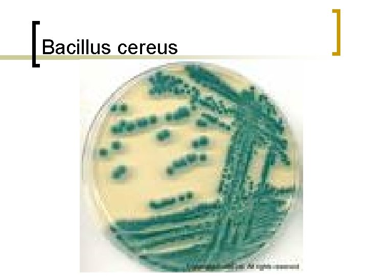 Bacillus cereus 