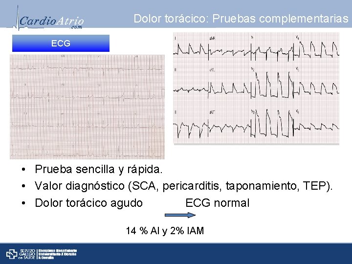 Dolor torácico: Pruebas complementarias ECG • Prueba sencilla y rápida. • Valor diagnóstico (SCA,
