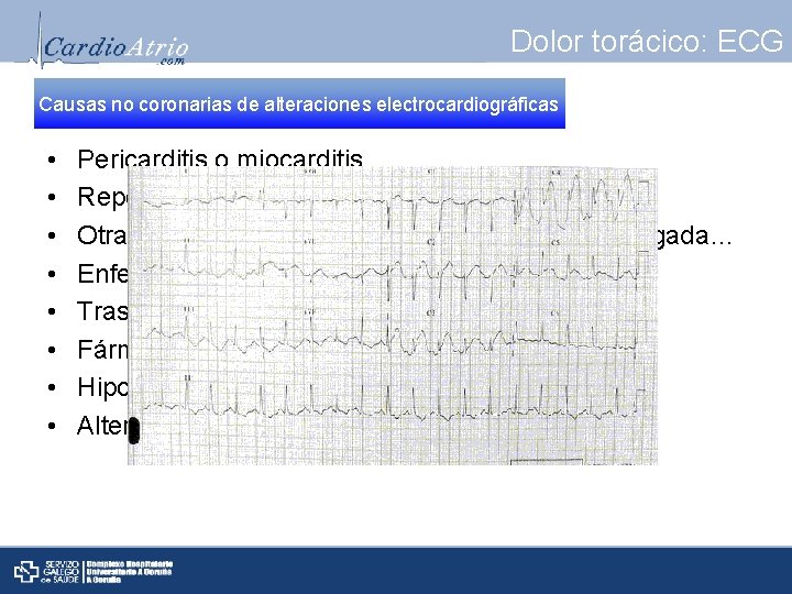 Dolor torácico: ECG Causas no coronarias de alteraciones electrocardiográficas • • Pericarditis o miocarditis.