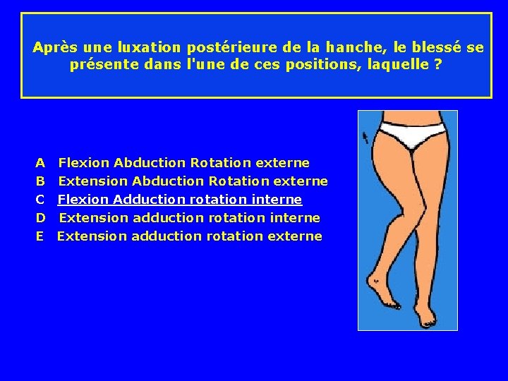 Après une luxation postérieure de la hanche, le blessé se présente dans l'une de