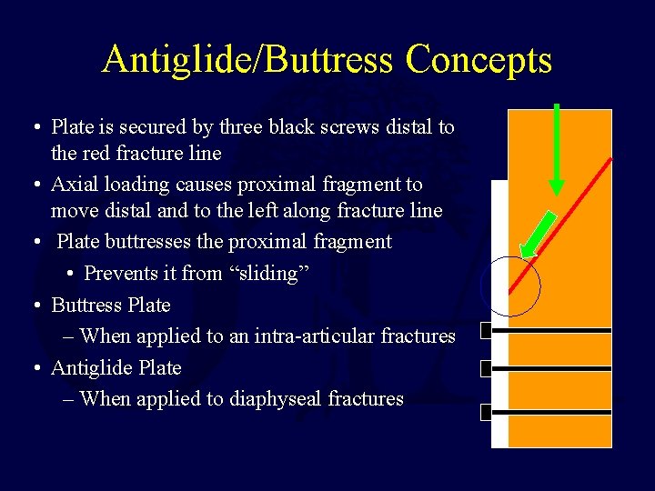 Antiglide/Buttress Concepts • Plate is secured by three black screws distal to the red