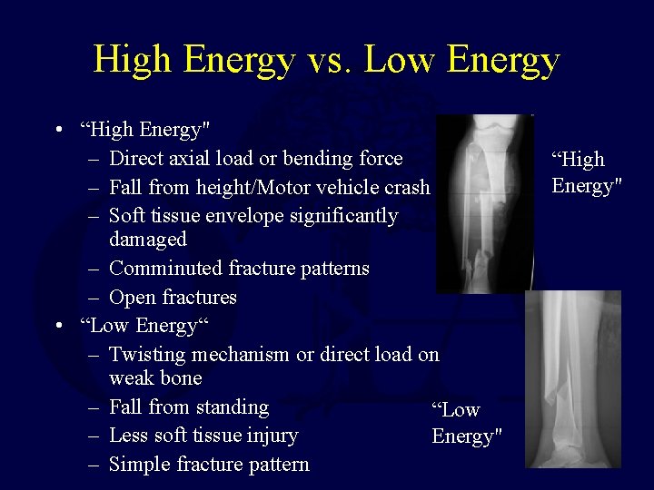 High Energy vs. Low Energy • “High Energy" – Direct axial load or bending