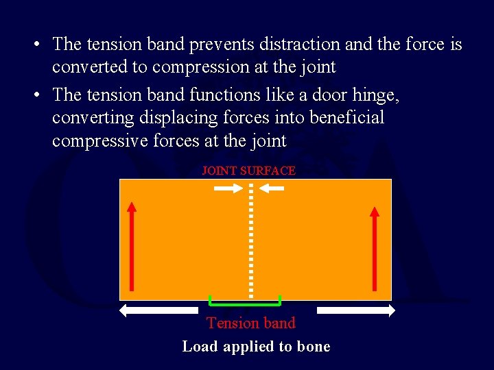  • The tension band prevents distraction and the force is converted to compression