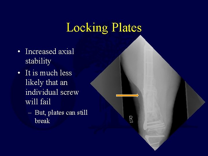 Locking Plates • Increased axial stability • It is much less likely that an
