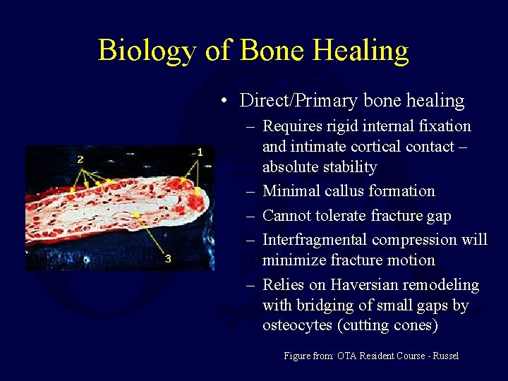 Biology of Bone Healing • Direct/Primary bone healing – Requires rigid internal fixation and