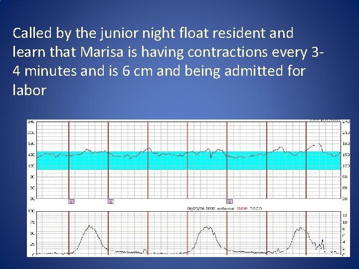 Called by the junior night float resident and learn that Marisa is having contractions