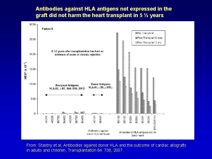 Antibodies against HLA antigens not expressed in the graft did not harm the heart