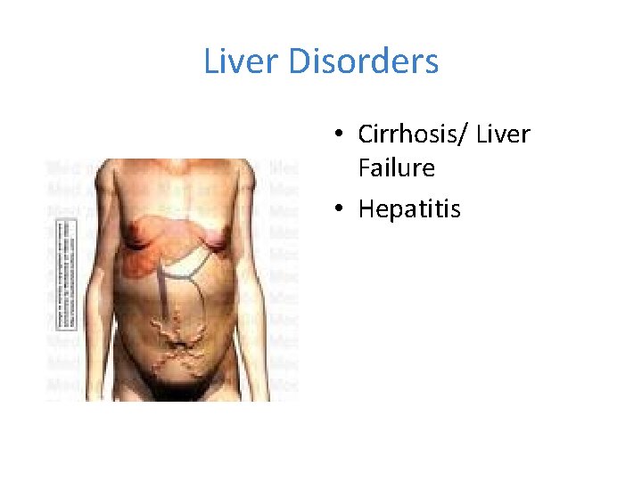 Liver Disorders • Cirrhosis/ Liver Failure • Hepatitis 