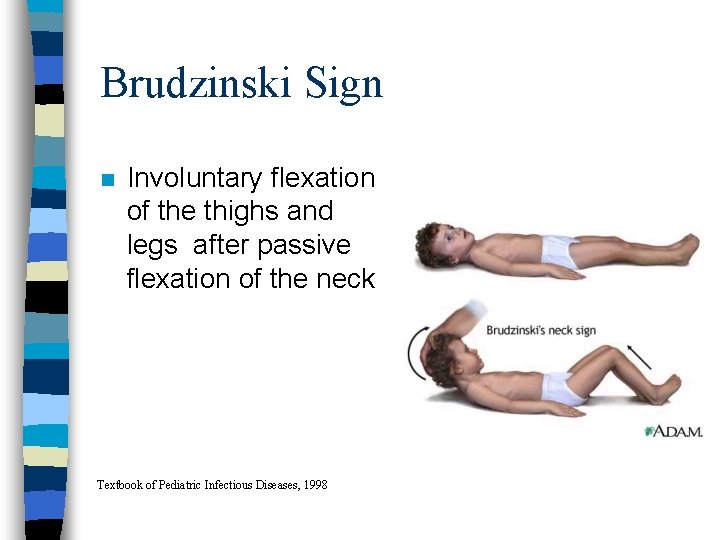 Brudzinski Sign n Involuntary flexation of the thighs and legs after passive flexation of