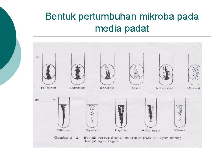 Bentuk pertumbuhan mikroba pada media padat 