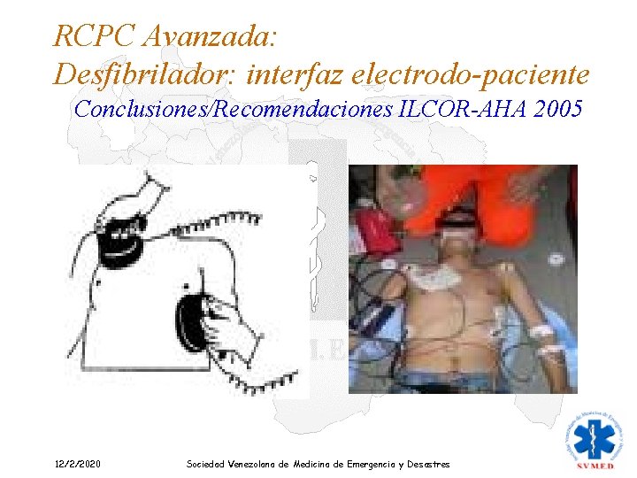 RCPC Avanzada: Desfibrilador: interfaz electrodo-paciente Conclusiones/Recomendaciones ILCOR-AHA 2005 12/2/2020 Sociedad Venezolana de Medicina de